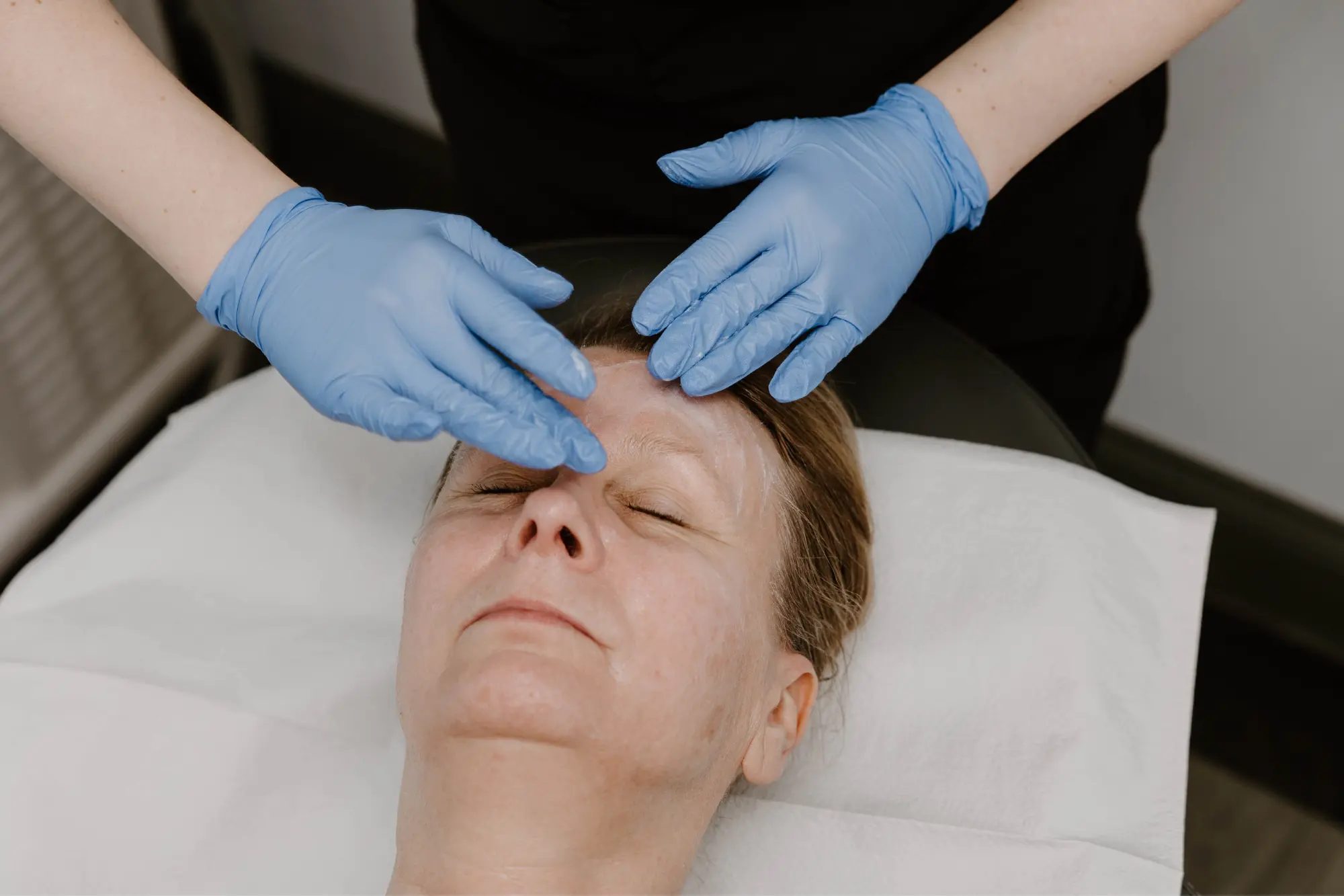 Biltmore Dermatology brown spot, age spot treatment!
